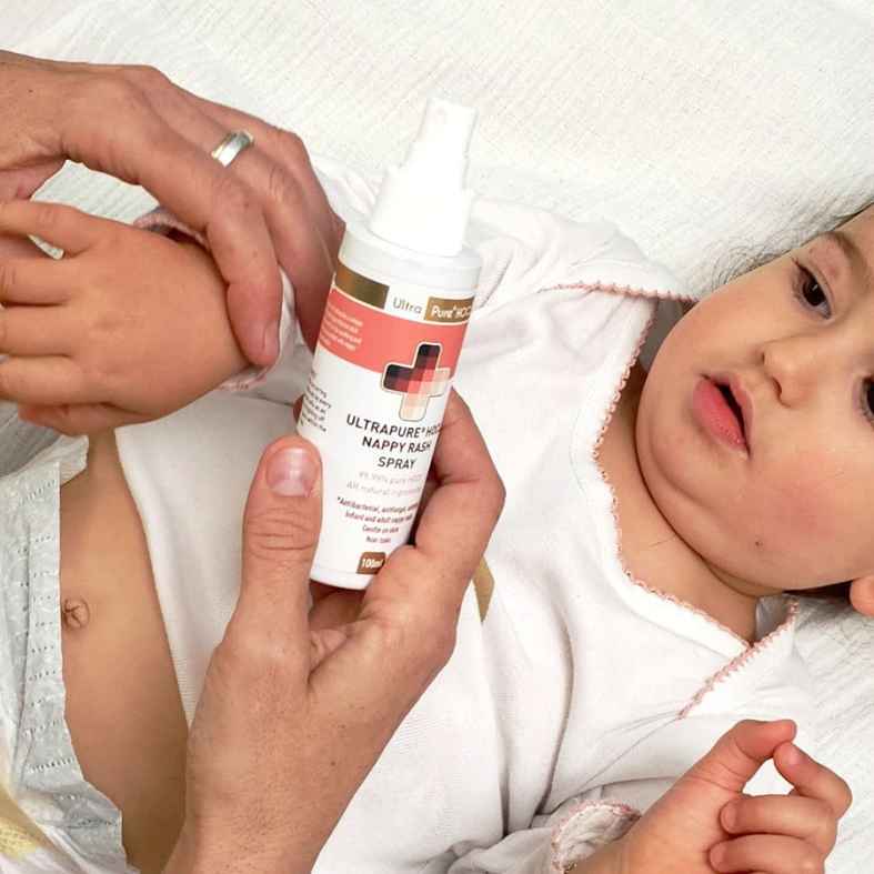 NAPPY RASH